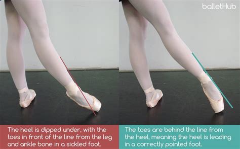 What is Sickled Feet in Dance?